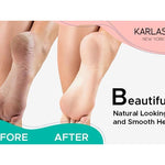 Professional_Best_Callus_Remover_Gel_for_Feet_and_Foot_Pumice_Stone_Scrubber_Kit_Remove_Hard_Skins_Heels_and_Tough_Callouses_from_feet_Quickly_and_Effortless_4_oz_(1_Bottle)