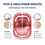 ORAVIX_Dental_Water_Flosser_Tonsil_Stone_Remover,_Oral_Irrigator_Water_Flosser,_Gentle_Water_Flosser_for_Sensitive_Teeth_and_Gums,_Kids_Water_Flosser,_Manual_Water_Flosser_No_Electricity_or_Batteries