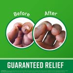 O'Keeffe's_Working_Hands_Hand_Cream_for_Extremely_Dry,_Cracked_Hands,_3.4_Ounce_Jar,_(Pack_1)