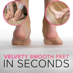 RUSTPROOF_Callus_Remover_for_Feet._Professional_Pedicure_Foot_File_(XL_Size)_Pedicure_Foot_Spa_Products,_Foot_Callus_Remover_Feet_Scrubber_for_Dead_Skin,_Wet_&_Dry_Use,_Non_Electric_Foot_Care_Kit