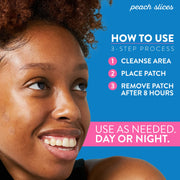 Peach_Slices_|_Acne_Spot_Dots_|_Hydrocolloid_Acne_Patches_|_For_Zits,_Blemishes,_&_Breakouts_|_Vegan_|_Cruelty-Free_|_Pimple_Patches_|_Facial_Skin_Care_Products_|_3_Sizes_(7mm,_10mm,_&_12mm)_|_30_Ct