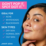 Peach_Slices_|_Acne_Spot_Dots_|_Hydrocolloid_Acne_Patches_|_For_Zits,_Blemishes,_&_Breakouts_|_Vegan_|_Cruelty-Free_|_Pimple_Patches_|_Facial_Skin_Care_Products_|_3_Sizes_(7mm,_10mm,_&_12mm)_|_30_Ct