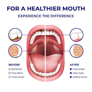 ORAVIX_Dental_Water_Flosser_Tonsil_Stone_Remover,_Oral_Irrigator_Water_Flosser,_Gentle_Water_Flosser_for_Sensitive_Teeth_and_Gums,_Kids_Water_Flosser,_Manual_Water_Flosser_No_Electricity_or_Batteries