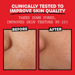 Thayers_Alcohol-Free_Rose_Petal_Witch_Hazel_Facial_Toner_for_Glowing_Skin,_Hydrating,_Refreshing_Toner_for_Normal_and_Combination(Skincare,_Comfort)