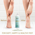 Extra_Strength_Callus_Remover_for_Feet_-_Callus_Remover_Gel_Foot_Scrubber_for_Dead_Skin_-_Professional_Pedicure_Foot_Spa_Essential,_6oz